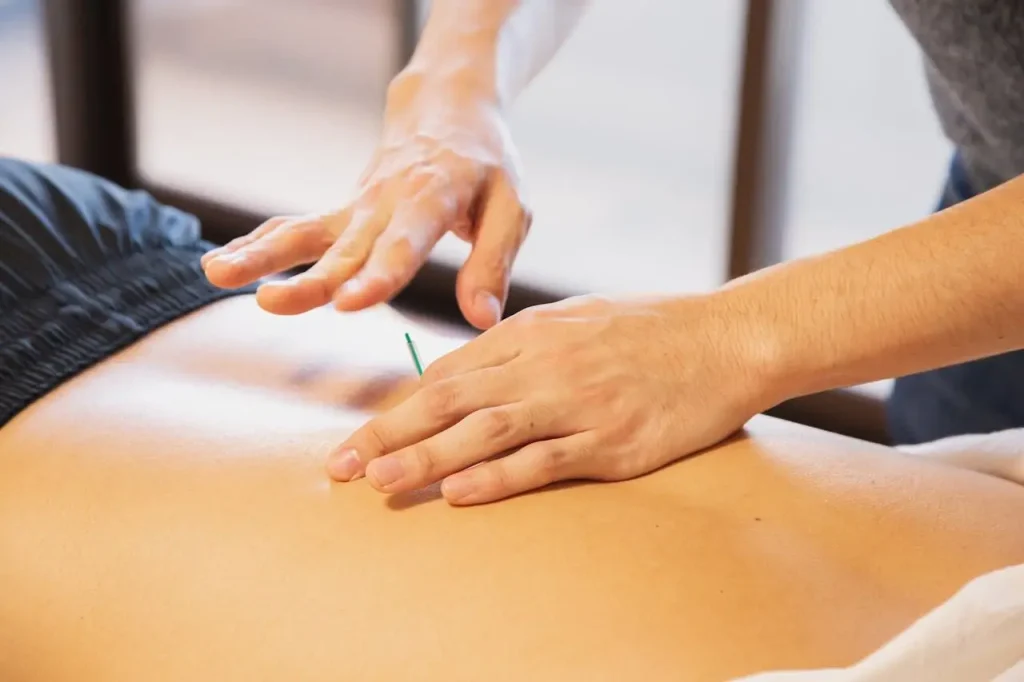 pexels-photo-5473184 Crop anonymous male doctor putting needles on back during acupuncture therapy session in rehabilitation salon